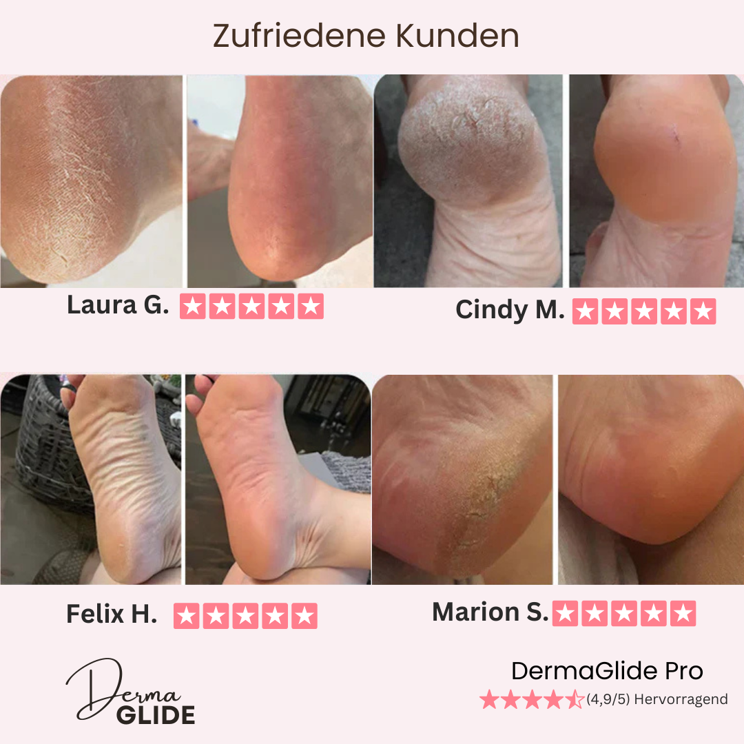 DAS ORIGINAL - DermaGlide Pro™