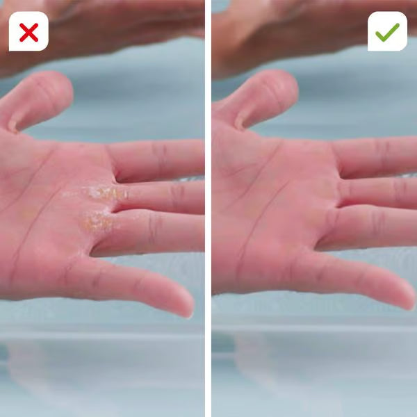 DermaGlide Pro inkl. 60 Glide Pads (Gratis)