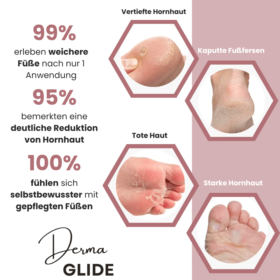 DermaGlide Pro inkl. 60 Glide Pads (Gratis) - DermaGlide