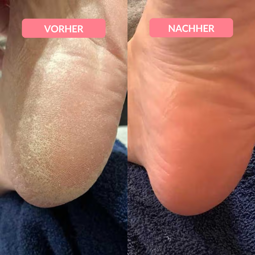 DAS ORIGINAL - DermaGlide Pro™