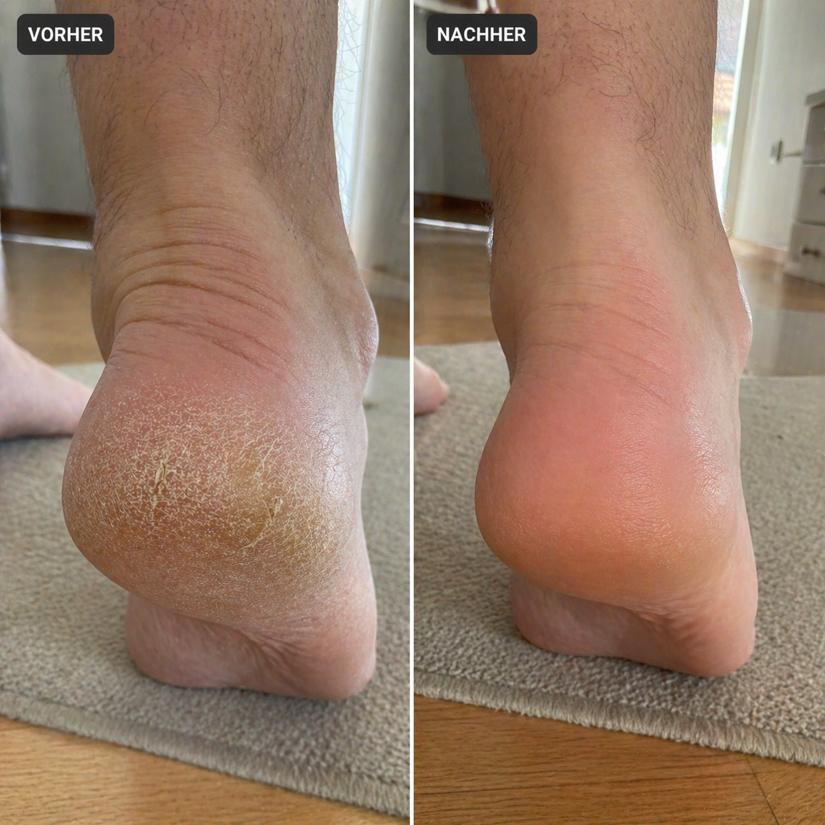 DermaGlide Pro 2.0 - Bild 8