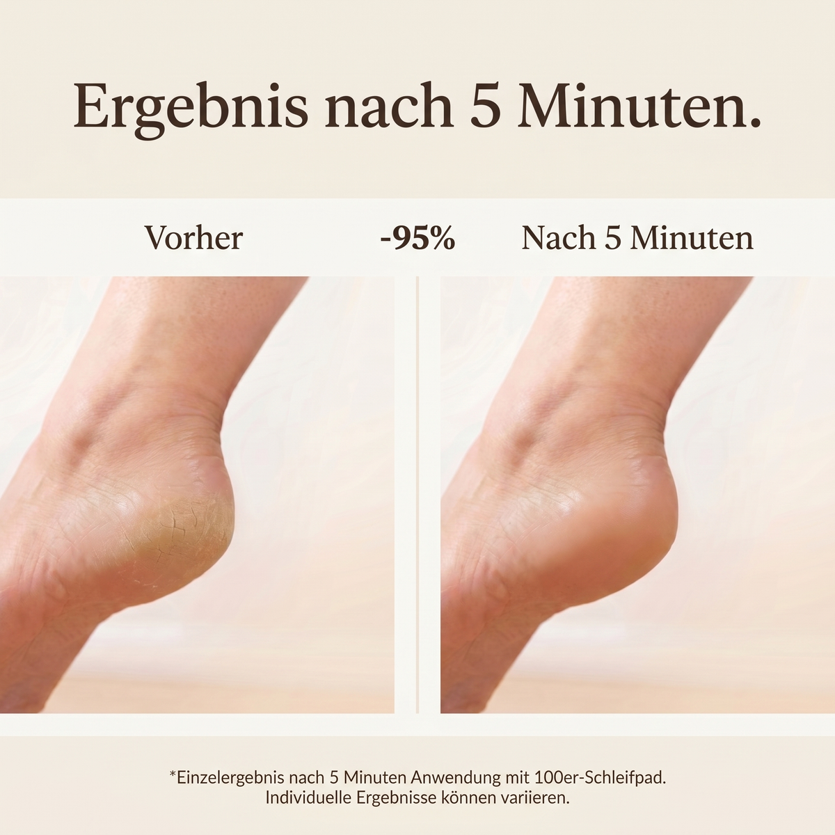 DermaGlide Pro 2.0 - Bild 6
